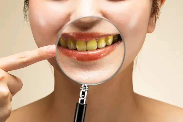 زرد شدن دندان ها