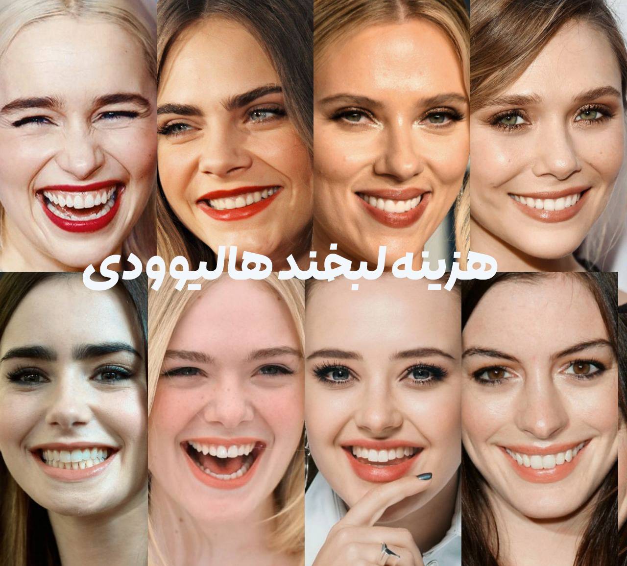 هزینه لبخند هالیوودی