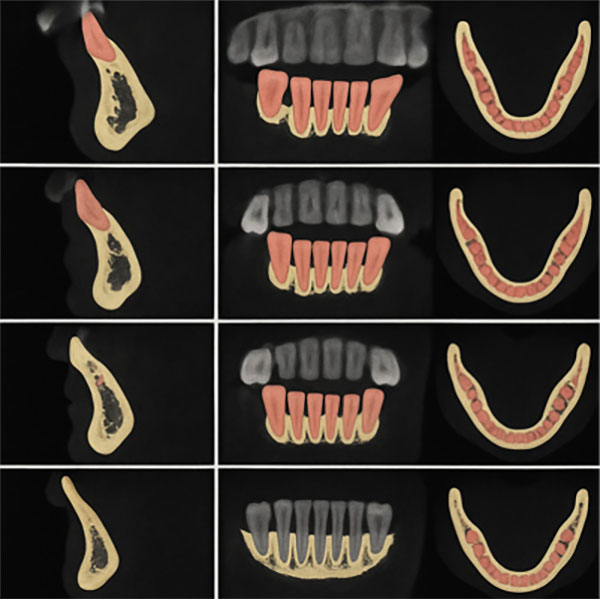خدمات-جانبی-و-عکس-CBCT
