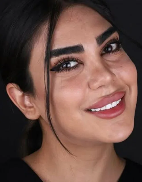 نمونه-کار کامپوزیت -دکتر-میری